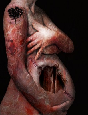 The_Infection_by_Yellowalrus.jpg